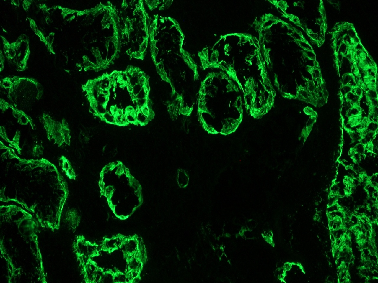 Figure 3. Immunohistochemistry on a frozen tissue sections of human kidney  with MUB0329P (RCK108; dilution 1:500).